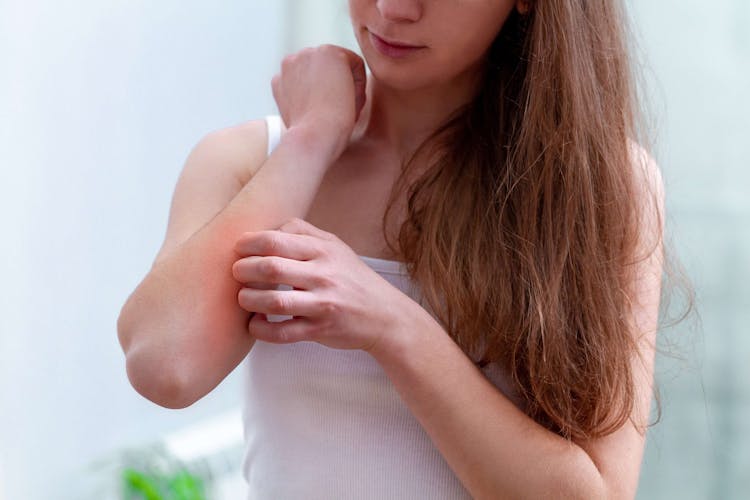 Alergia de pele: causas, sintomas e tratamentos